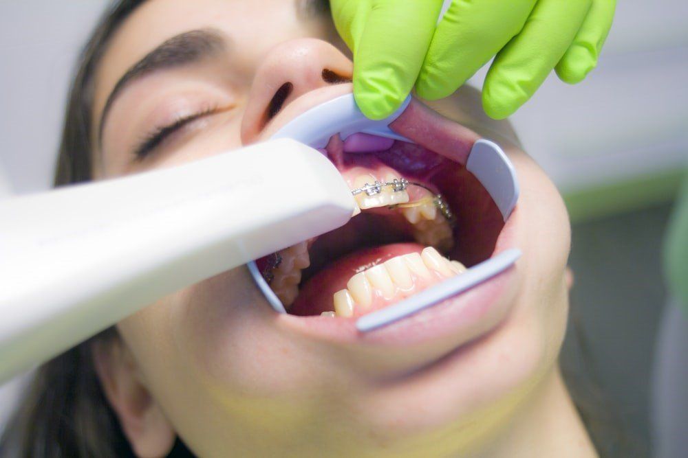 prevent-cavities
